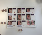 Landa Hearing Center－Audiologist／Hearing aids, MD